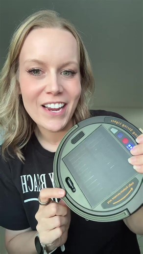 These solar camping string lights are rechargeable, waterproof, and perfect for camping, patios, or emergency lighting. #CampingGear #OutdoorEssentials #TikTokShopFinds #CampingLife #OutdoorLiving ⛺✨