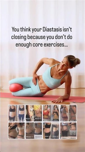 Your Diastasis Isn’t Closing? Here’s What You’re Missing 😳