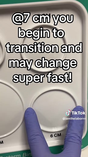 The cervix opens up to allow passage of the baby through the birth canal! It all begins with contractions that will dilate (open) the cervix! #childbirth #pushing #cervix #fypシ゚viral #pregnancy #laboranddelivery #labor
