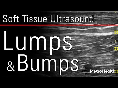 Soft Tissue Ultrasound: Lumps & Bumps