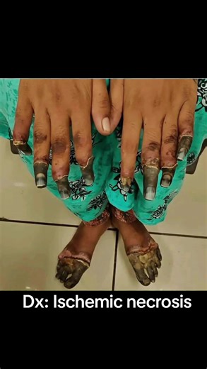 Hajj. Dr Jibril on TikTok