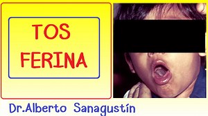 Tos ferina (síntomas, causas, vacuna, tratamiento) La TOSFERINA es una enfermedad extremadamente contagiosa provocada por la bacteria BORDDETELLA PERTUSSIS. Su nombre viene dado por una tos severa característica en salvas que va seguida por una inspiración que suena como un grito o "gallo" (estridor). Eso se debe a que la espiración causa una espiración completa. Aunque ese estridor ("gallo") inspiratorio se describe como típico, sólo ocurre en niños escolares y preescolares, pero es rara su ocu