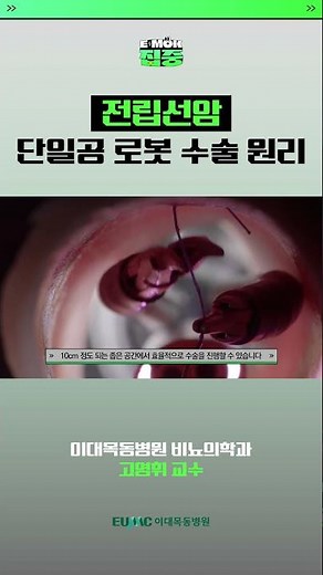 전립선암 '단일공 로봇 수술' 원리
