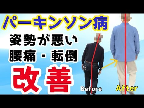 【転倒・腰痛からの解放】パーキンソン病の姿勢改善セラピー