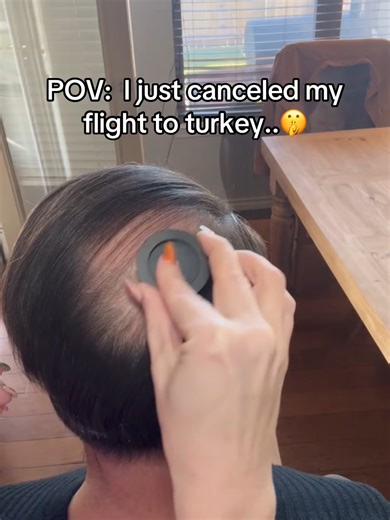 Hairline Powder - Instant Hair Confidence Booster for Natural Looking Thicker Fuller Hair#TikTokMadeMeBuyIt #hairline #finehair