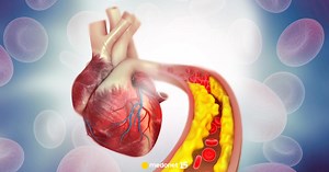 Czym jest cholesterol nie-HDL? Badanie i normy cholesterolu nie-HDL