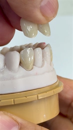 The Zirconia veneers! Dr.Luciana Pavie in Massachusetts | CEO Luke Kahng