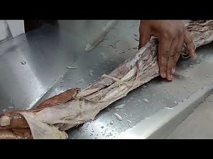 Upper limb 02 || Anatomy || Dissection