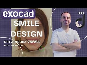 Smile Design 3D - Exocad (p1)