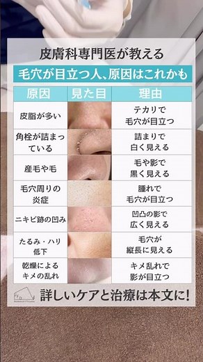 【毛穴が目立つ人必見】毛穴の原因これかも#皮膚科専門医 #美容皮膚科 #肌質改善