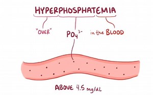 【搬运osmosis】Hyperphosphatemia