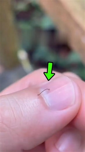 If This Tiny Worm Climbs Your Body…