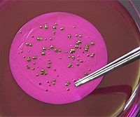 Isolation and Identification of Fecal Bacteria from Water