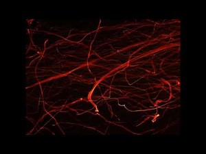 Reward Circuit and Nucleus Accumbens