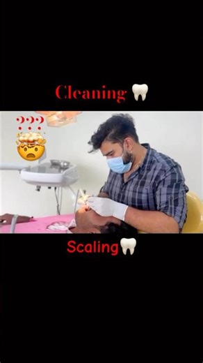 Scaling #tooth cleaning # dental calculus#dental stains #Nexuss dental care #nexxussdentalclinic