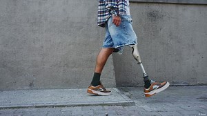 Affordable prostheses with innovative 3D printing