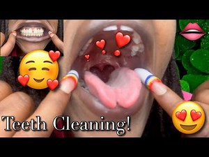 I Found A Dentist! | Spring 2025 Mouth Tour & Update