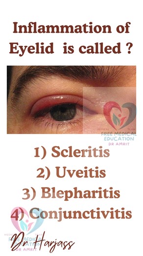 53K views · 2.3K reactions | Medical quiz reels | Free medical education | Facebook