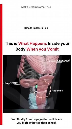 🤮 This is what happens inside 🧠 your body when you Vomit 🤢 | MDCT