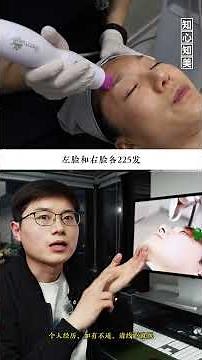 Common Thermage treatment probes! 225 shots for the eyes and 600 shots for the face. How much doe...
