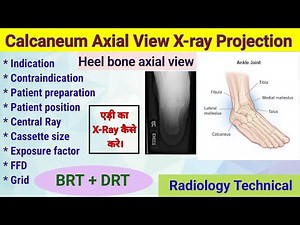 Calcaneum Axial View X-ray Projection # Heel bone radiography # Patient positioning #radiography