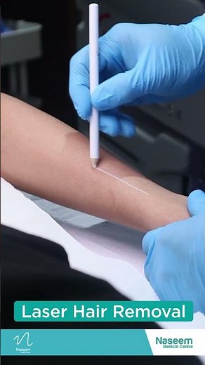 Laser Treatment for Hair Growth Control | Dr. Amina Binsy | Dermatologist | Naseem Medical