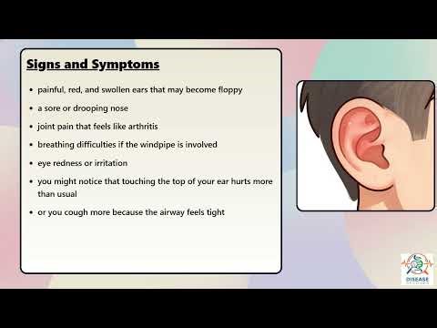 Relapsing Polychondritis Explained Causes, Symptoms and Treatment, All Insights
