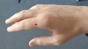 Palm Hand Bloody Scratch Stock Footage Video (100% Royalty-free) 3637783583 | Shutterstock