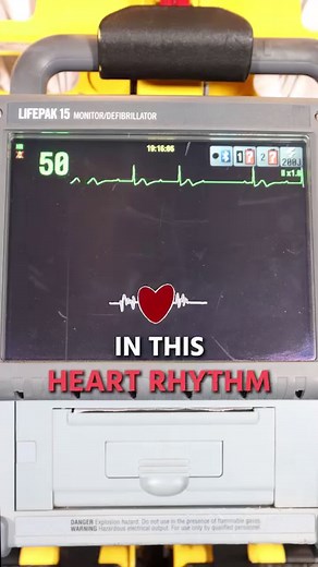 11K views · 296 reactions | The PRI is the key to understanding heart blocks. #cardiology #ecg #emslife | The Paramedic Coach | Facebook