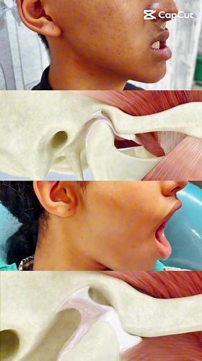 Temporomandibular Joint Disorder: Causes and Solutions