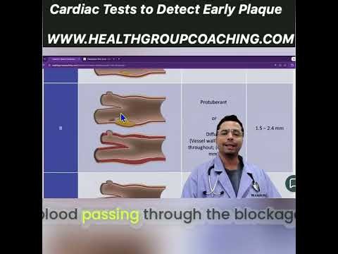 Coronary Artery Calcium Score: Your Heart Health Guide