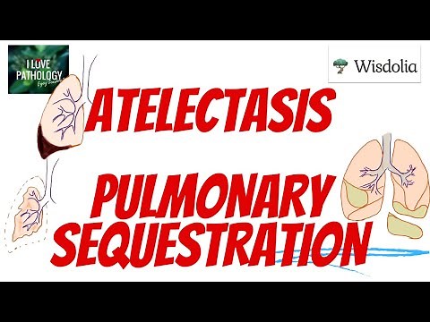 ATELECTASIS | PULMONARY SEQUESTRATION| Morphology| Types | prognosis