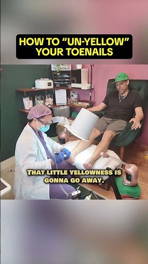 Why Your Toenails Turn Yellow (and the $3 Fix No One Tells You) 👀🦶