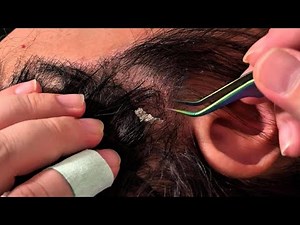Jojo’s ASMR Scalp Care — Gentle Tweezer Movements for Quiet Relaxation | No Talking