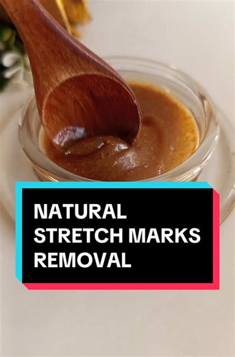 Effective Natural Stretch Mark Removal Techniques