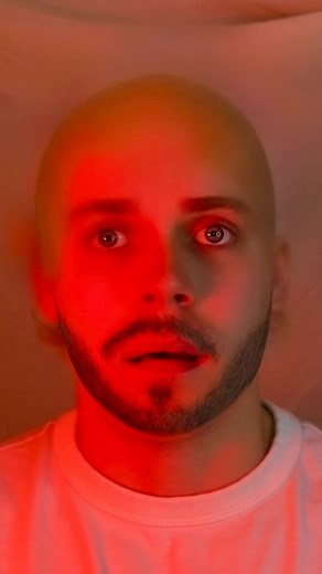 Go2 Hair on Instagram: "Fact of myth? ⬇️ Is there a link between hair loss and the ability to grow a beard? Should young men with beards be worried? The most direct study on this is old (Farthing, 1982), but may still offer useful info: 1. Men with high testosterone usually have healthy hair follicles, which helps with beard growth. 2. More testosterone leads to more DHT, which helps facial hair grow. 3. However, DHT may cause hair loss on the scalp. So, does growing a beard mean you’ll lose hai