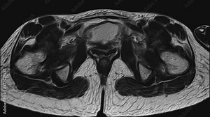 Voluminous MRI of the female pelvic organs, abdominal cavity, gastrointestinal tract and bladder