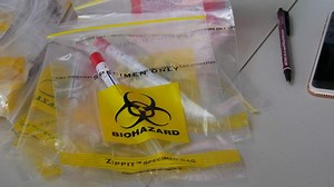 The exponential growth of coronavirus can be explained by rice on a chessboard. And we should be worried