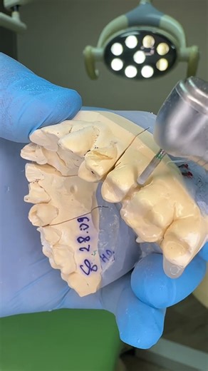 #dentalcare #satisfying #dentist #dentistry #dentalclinic #satisfyingvideo #dentistry #jazz