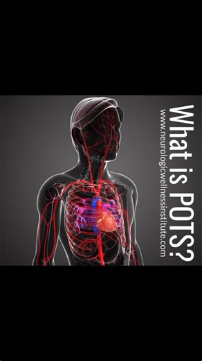 1. What is POTS? Postural Orthostatic Tachycardia Syndrome (POTS) is a condition characterized by an excessive heart rate increase when transitioning from lying down to standing. 2. What are common symptoms of POTS? Symptoms include dizziness, fainting, rapid heartbeat, fatigue, and sometimes cognitive difficulties upon standing. 3. How is POTS diagnosed? POTS is typically diagnosed through a tilt table test or a standing test that measures heart rate and blood pressure changes upon standing. Bo