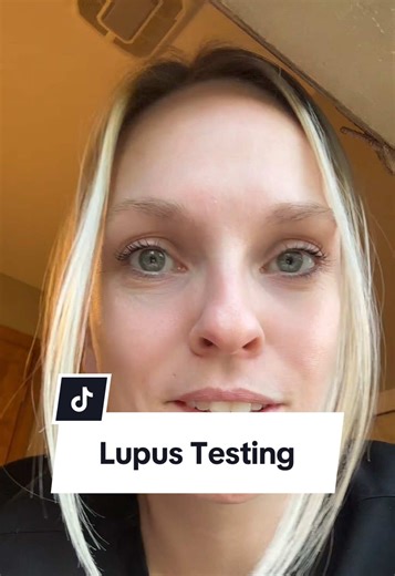 How to Accurately Test for Lupus Symptoms