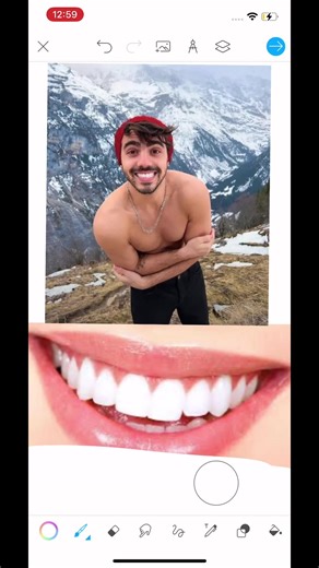 ¡Descubre la verdad sobre los dientes de Fede!