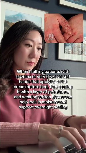 How to Heal Dry, Cracked Hands Overnight