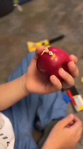 35K views · 299 reactions | Milk Teeth ❤️❤️ #Dentistry #Fun #BitesnBraces #smile #medical #People #dentista #Tooth #Implant #Dental | Bites & Braces Dental | Facebook