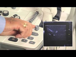 Logiq Needle Visualization