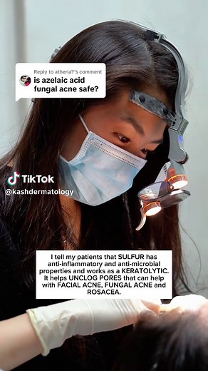 Benefits of Sulfur Soap for Your Skincare Routine