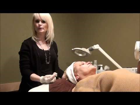 Chemical Peel Demonstration