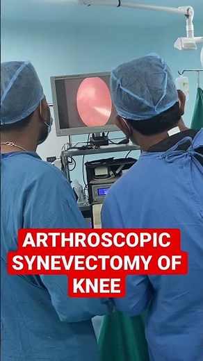 Arthroscopic synovectomy surgery of knee for Synovitis of knee in Jaipur