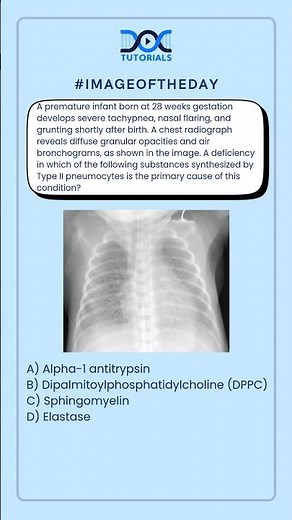 Premature Infant with Tachypnea & Grunting: Identify the primary cause of this condition