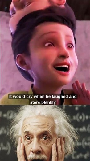 The Boy Born With Two Heads | A Tragic True Story 😨 #shorts #shortvideo